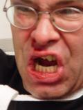 No lip stitches